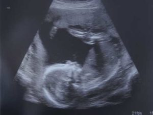 baby 300x225 baby