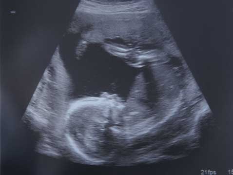 baby baby Its A....