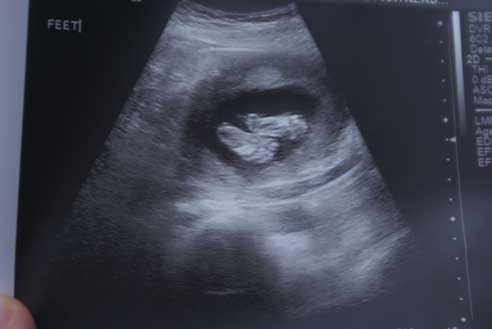 babys-feet babys feet Its A....